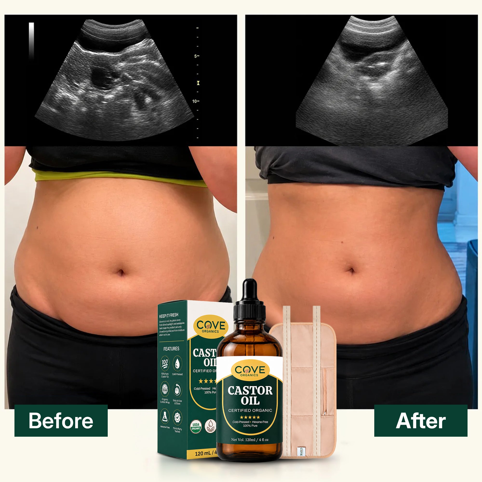 Castor Oil Detox Kit